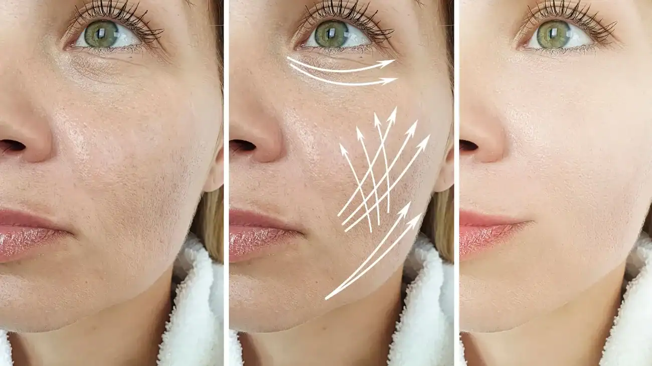Can One Treatment Really Tackle More Than One Skin Concern Ledbury?