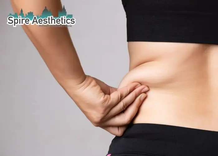 Image of woman pinching fat on their hips Ledbury. Fat Freezing treatment