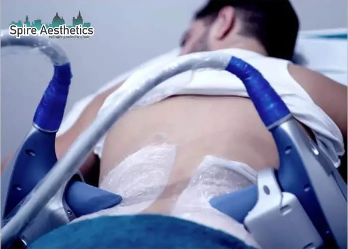 Man having fat freezing treatment done on love handles before a competitions Ledbury to create a sculpted look.