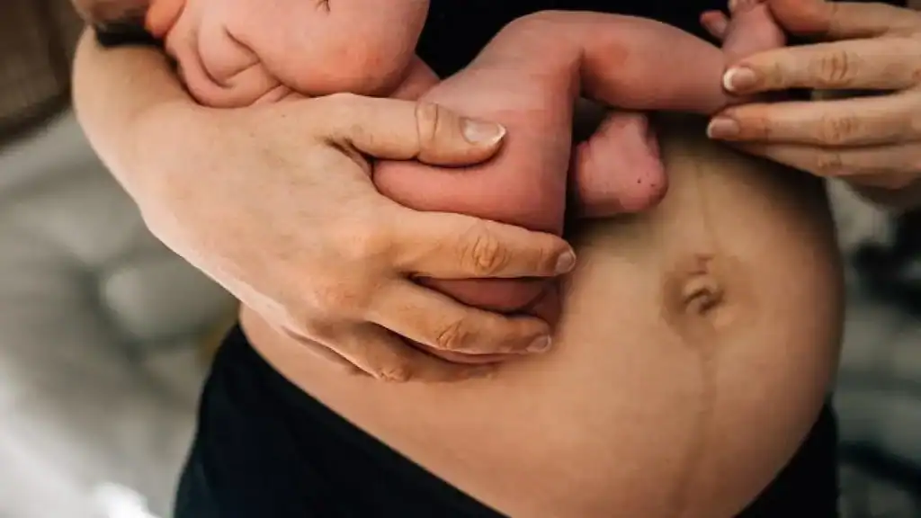 Why Is My Stomach Still Big After Pregnancy Ledbury?