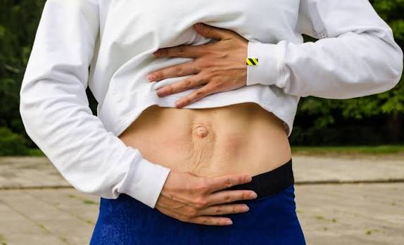 When Could Diastasis Recti Be the Missing Piece of the Puzzle Ledbury?